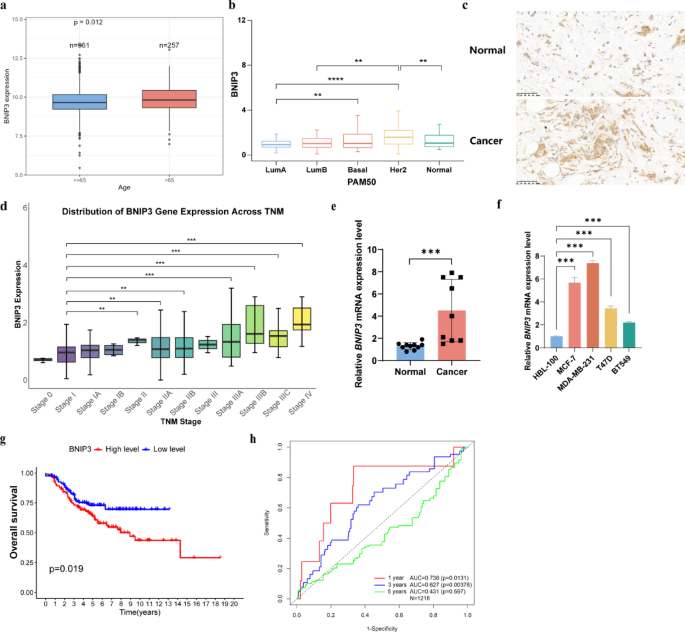BNIP3 is a key driver of breast cancer progression and a novel glycolysis-regulating biomarker