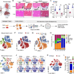 CD160+ intraepithelial lymphocytes and CCRL2+ macrophages drive differential repair in cardiac and liver injuries