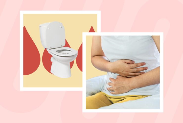 5 Early Signs and Symptoms of Ulcerative Colitis