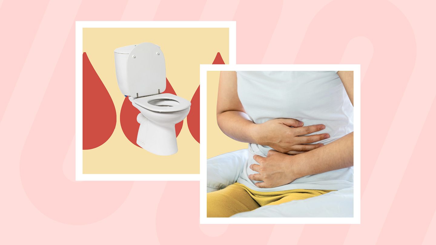 5 Early Signs and Symptoms of Ulcerative Colitis