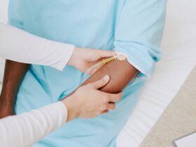 How to Prepare for an Eosinophilic Esophagitis (EoE) Endoscopy When Switching Treatments