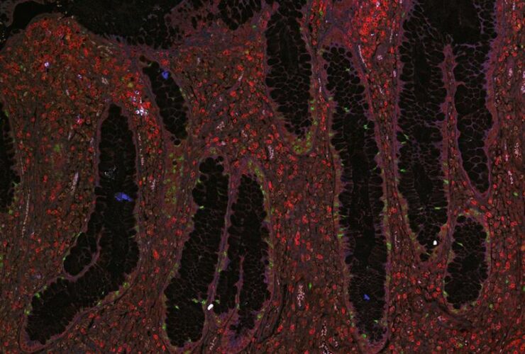 Heterogeneity of the intestinal mononuclear phagocyte compartment in health and inflammatory bowel disease | Science Immunology