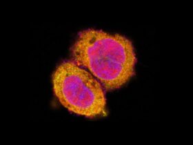 Human OCEL1 senses bacterial infection to unlock inflammatory responses | Science Immunology