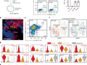 Human gut M cells resemble dendritic cells and present gluten antigen