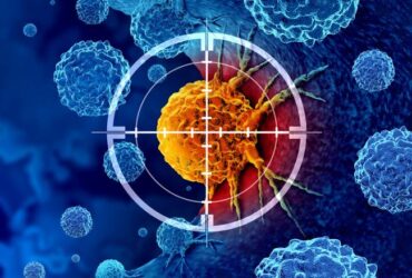 NIH-led study reveals role of mobile DNA elements in lung cancer progression