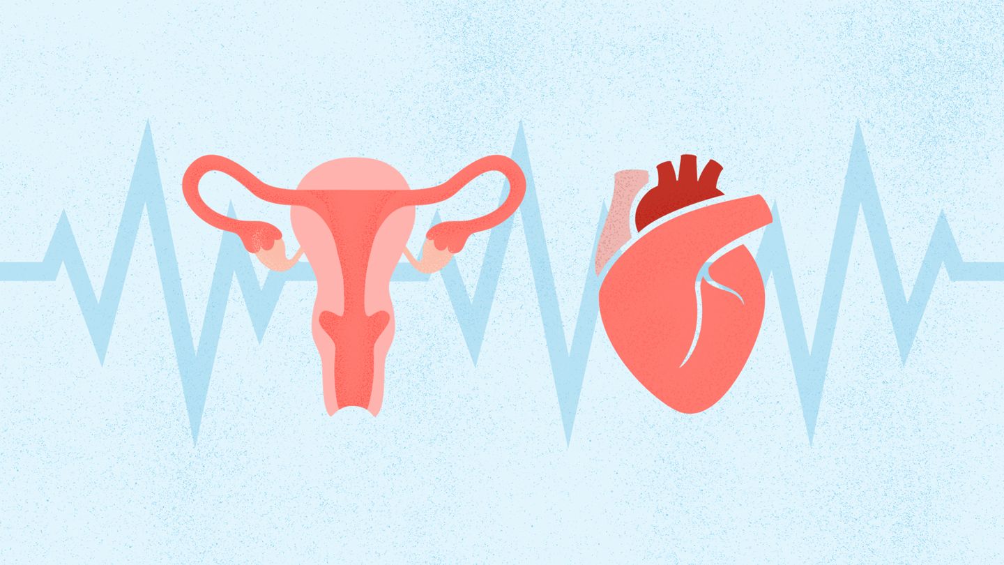 Uterine Fibroids Could Significantly Increase Heart Disease Risk