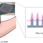 Precision dosing of recombinant vaccinia vaccine via pillar-guided microneedle patch confers SARS-CoV-2 immunity