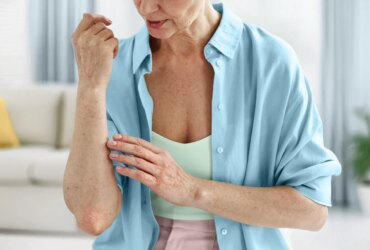 woman looking at a rash on her elbow