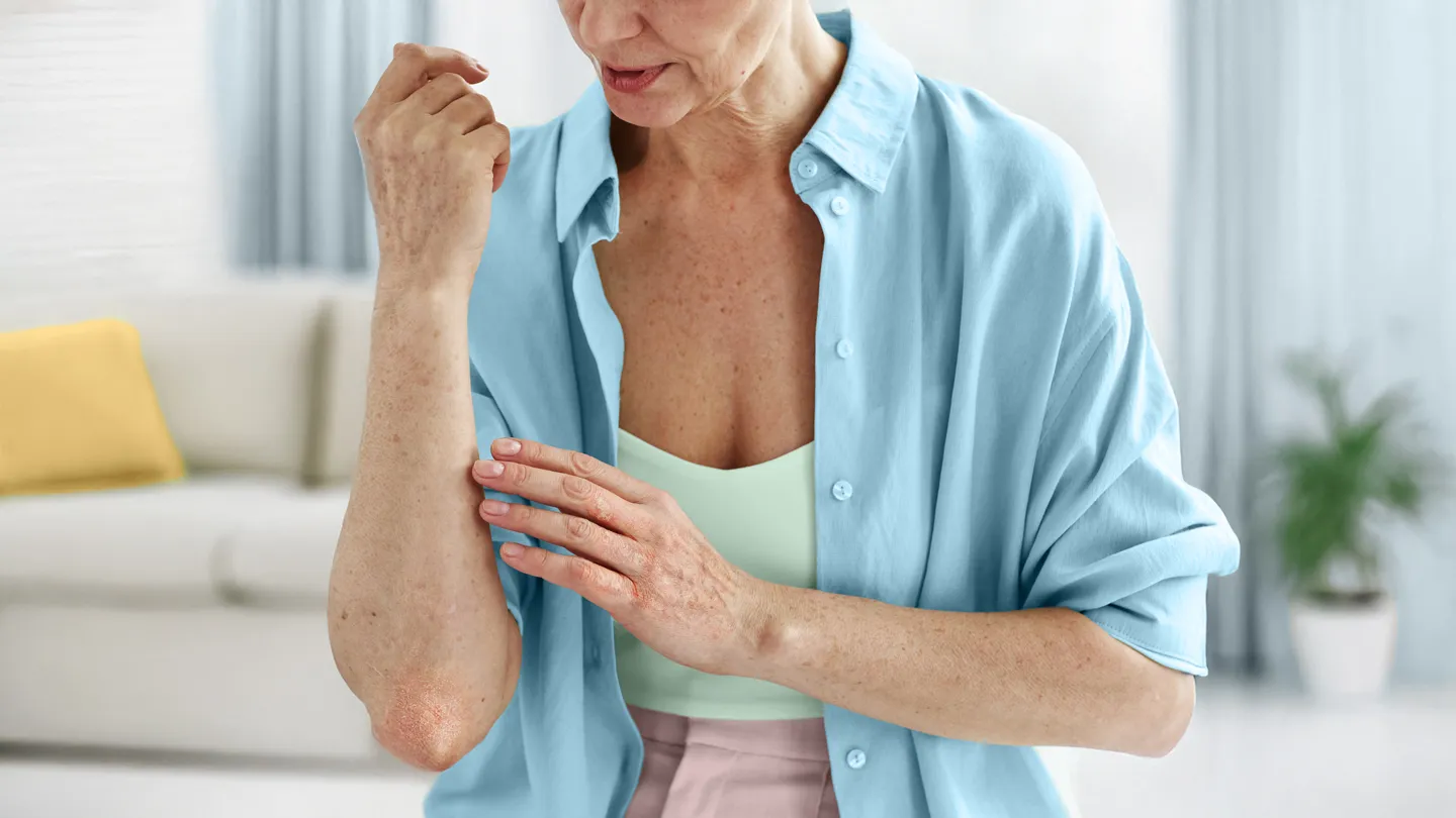woman looking at a rash on her elbow