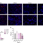 Role of innate immune and inflammatory signaling in West Nile virus tropism and neuronal and glial cell death
