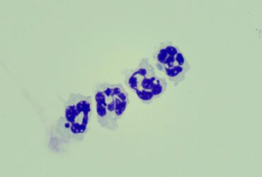 Siglec-F+ neutrophils promote the resolution of acute lung injury through ALOX15 induction | Science Immunology