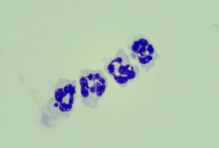 Siglec-F+ neutrophils promote the resolution of acute lung injury through ALOX15 induction | Science Immunology