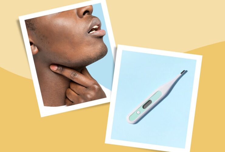 Strep Throat Symptoms and Diagnosis