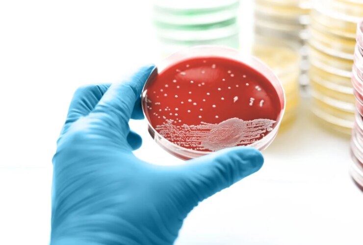 What Is Pseudomonas aeruginosa?