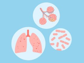 What Is a Klebsiella Pneumoniae Infection?