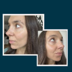 Women Of All Ages Say This Treatment Makes Their Skin Look Firm, Plump, & Youthful