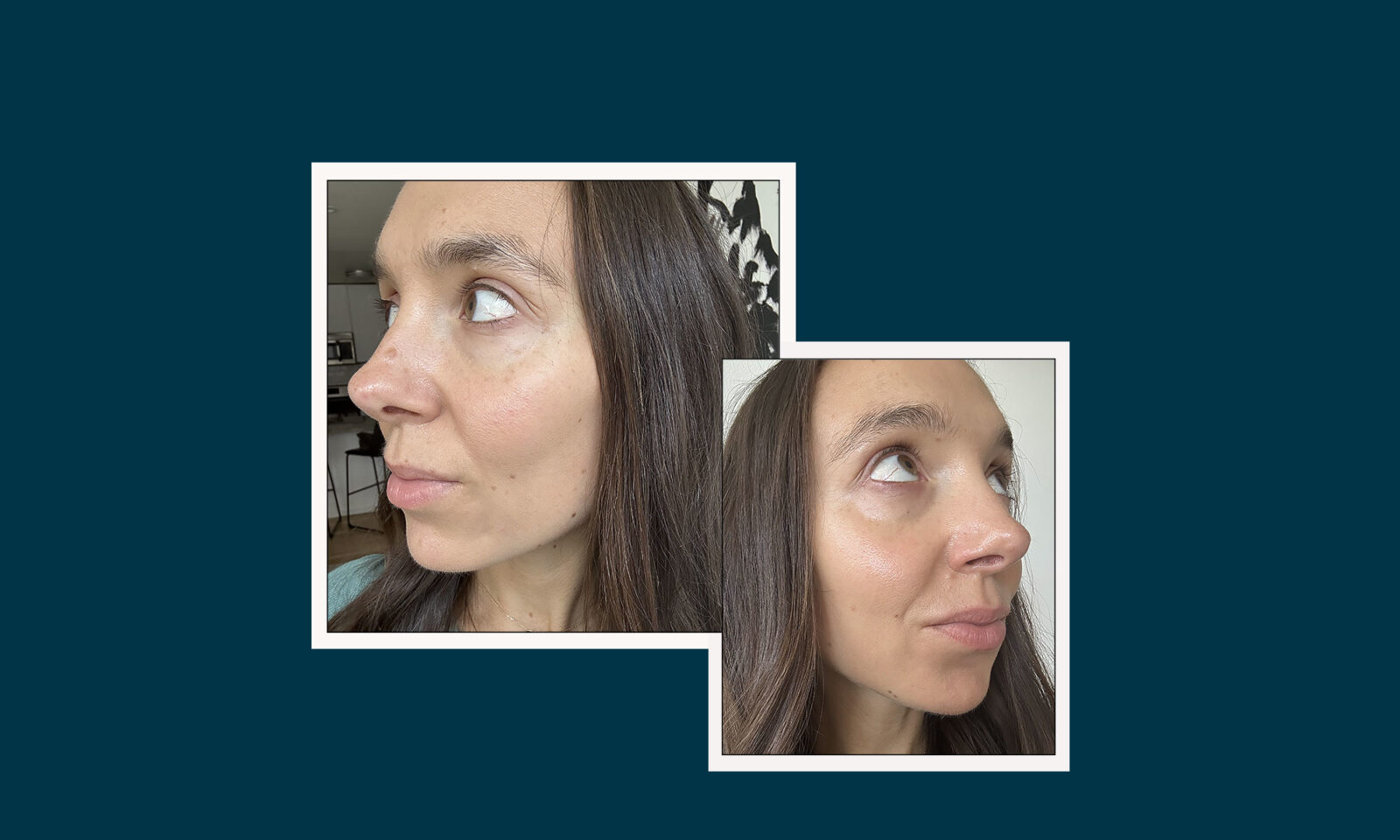 Women Of All Ages Say This Treatment Makes Their Skin Look Firm, Plump, & Youthful