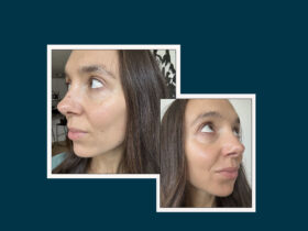 Women Of All Ages Say This Treatment Makes Their Skin Look Firm, Plump, & Youthful