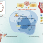 YTHDF3 suppresses interferon-stimulated gene (ISG)-dependent antitumor immunity and promotes HPV carcinogenesis in cervical cancer