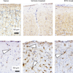 A molecular circuit at the brain border that drives gray matter injury