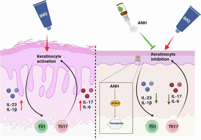 Anhydroicaritin-loaded mesenchymal stem cell exosomes ameliorate psoriasis via ACSL4-mediated ferroptosis in mice