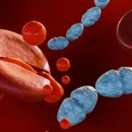 Breakthrough sepsis drug shows promise in human trial