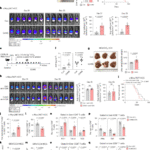 Chronic stress drives liver cancer by impairing the hepatic kynurenine pathway and immune surveillance