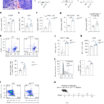 DNA damage in macrophages drives immune autoreactivity via nuclear antigen presentation