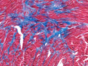DNA-damaging chemotherapy reshapes cardiac-resident macrophage composition and function | Science Immunology