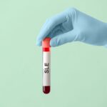 Is It Systemic Lupus Erythematosus (SLE) or Another Type of Lupus?