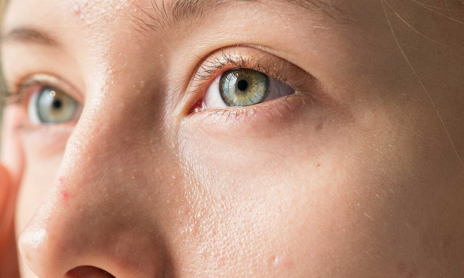 Dry Eye After LASIK or Vision Correction? What To Know