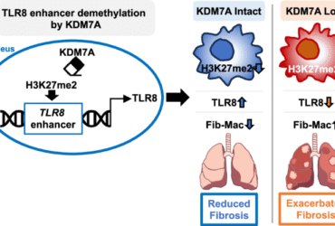 Histone demethylase KDM7A negatively regulates fibrotic macrophage polarization and lung fibrosis progression