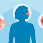 How to Identify Lupus Rash and Other Skin Symptoms of the Condition