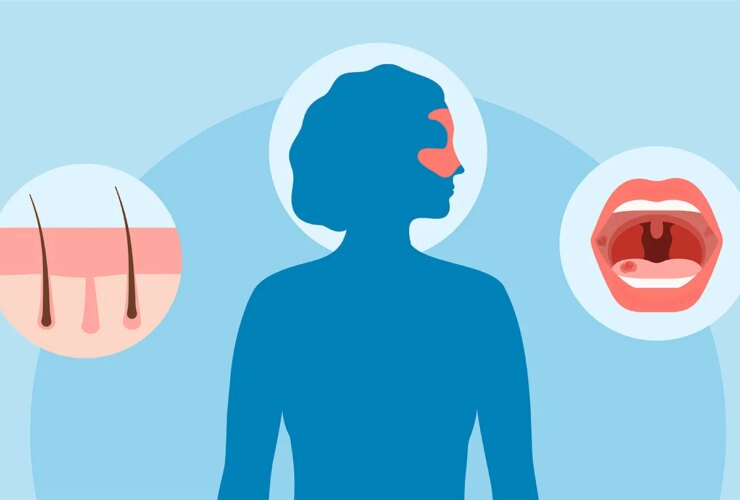 How to Identify Lupus Rash and Other Skin Symptoms of the Condition