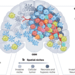 Immunosuppressive mechanisms and therapeutic interventions shaping glioblastoma immunity