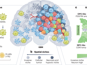 Immunosuppressive mechanisms and therapeutic interventions shaping glioblastoma immunity