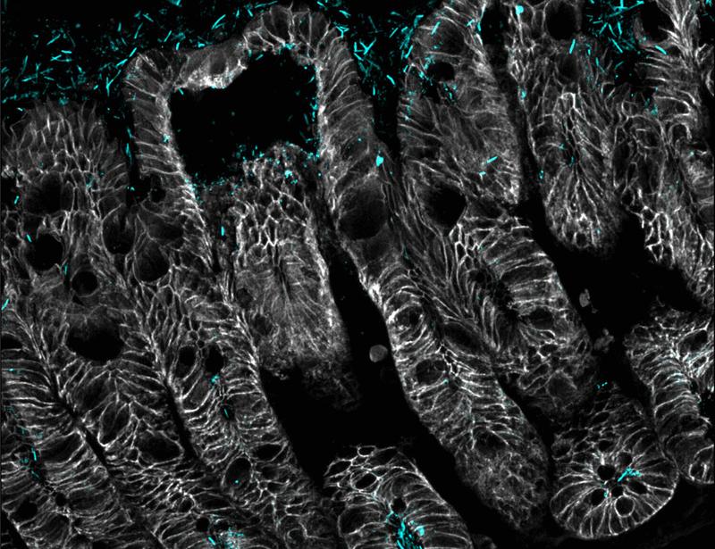 Intestinal epithelial TLR5 signaling promotes barrier-supportive macrophages | Science Immunology