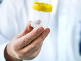 How a Kidney Infection Is Diagnosed