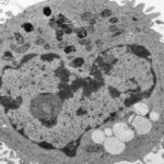PTMA safeguards mitochondrial integrity to sustain metabolic function and antitumor activity of CD8 T cells | Science Immunology