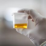 Proteinuria in Complement 3 Glomerulopathy: Why It Matters
