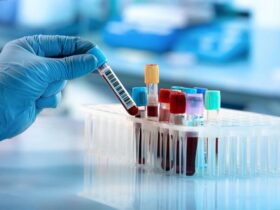 Researchers identify new blood markers that may detect early pancreatic cancer