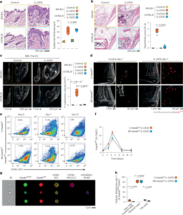Skin-derived myeloid precursors and joint-resident fibroblasts spread psoriatic disease from skin to joints