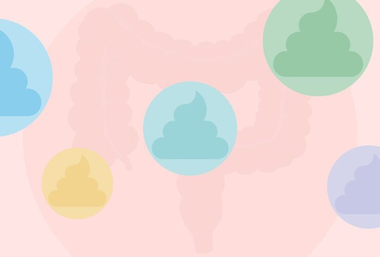 Weird-Looking Stools: How Your Poop Can Signal Colon Cancer