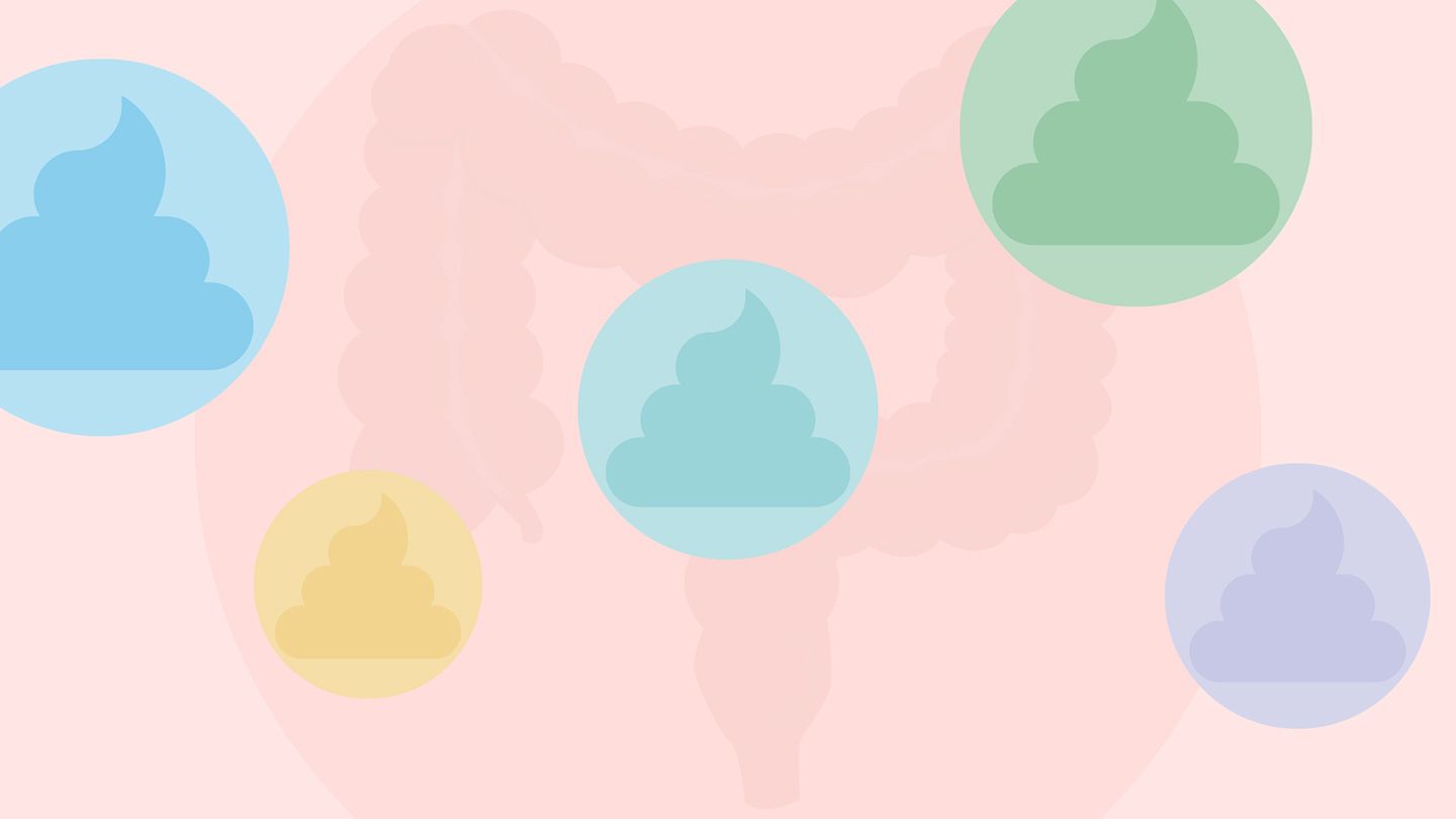Weird-Looking Stools: How Your Poop Can Signal Colon Cancer