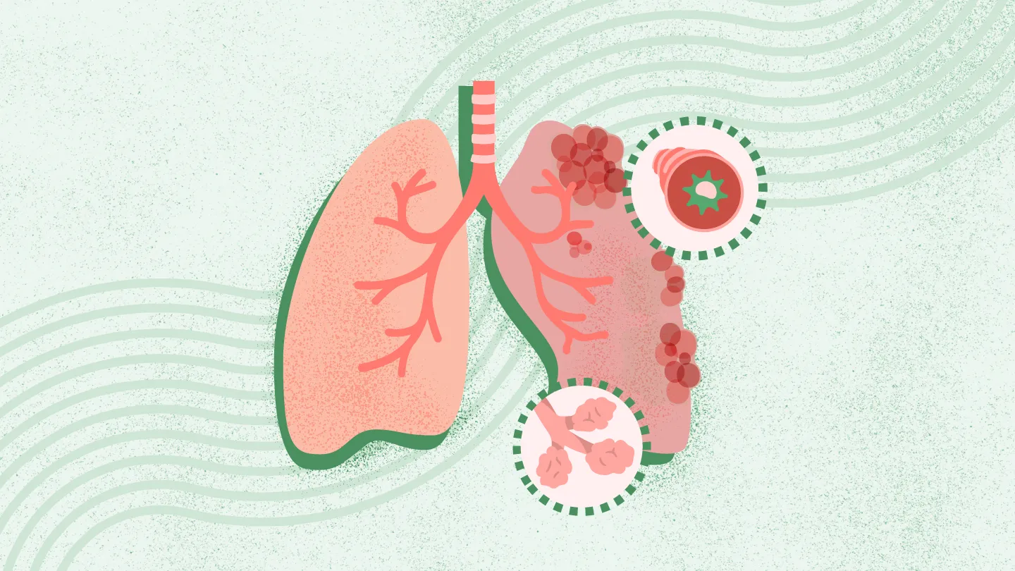 What Is COPD? Symptoms, Causes, Diagnosis, Treatment, and Prevention