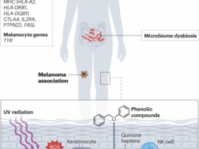 The immunology of vitiligo | Nature Reviews Immunology