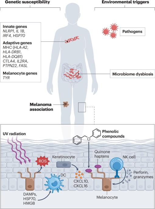 The immunology of vitiligo | Nature Reviews Immunology
