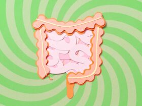 4 Supplements to Avoid If You Have Ulcerative Colitis