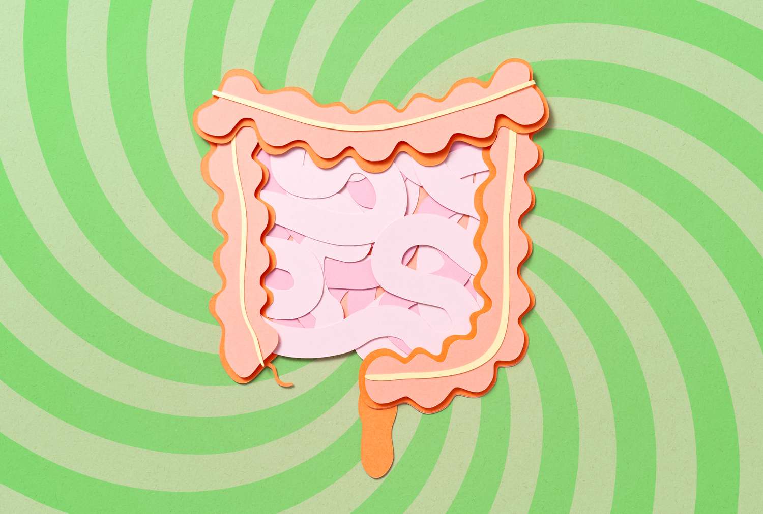 4 Supplements to Avoid If You Have Ulcerative Colitis