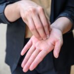 5 Possible Causes of a Purple Finger